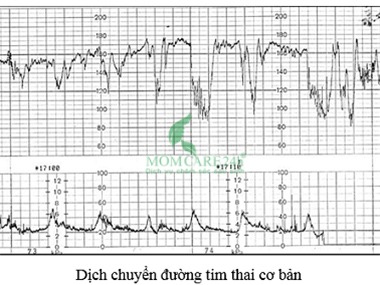 3) Các Kết luận bình thường/bất thường, đánh giá, cảnh báo… sẽ do BS.ThS.CKII Lê Thanh Hùng phụ trách